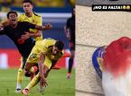 Efter en blodig smäll kan Lamine Yamal missa Barcelonas stora match i morgon