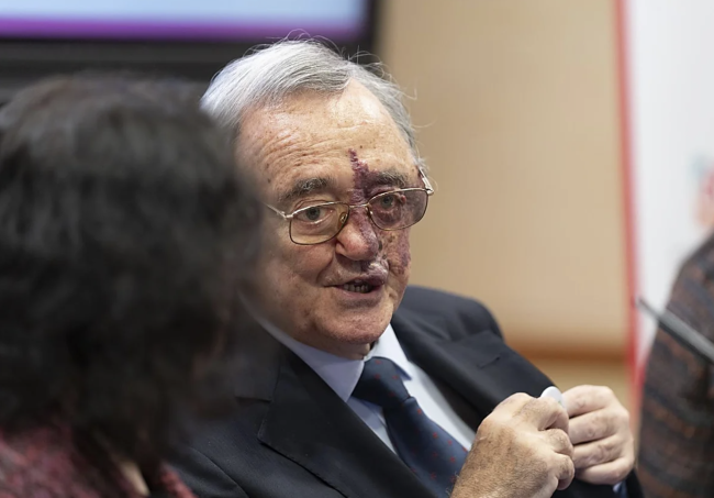 Insamlingskampanj inledd för att stödja Spaniens genombrott inom forskning om bukspottkörtelcancer