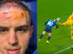 Atalantas Nikola Krstović visar pannan efter en dramatisk straff i sista minuten mot BVB