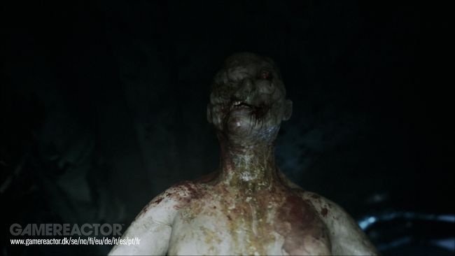 Ill
